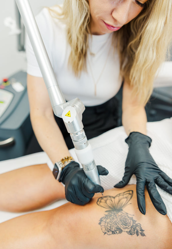 Laser Tattoo Removal