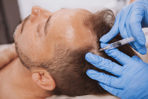 PRP Hair Restoration | 3 Session