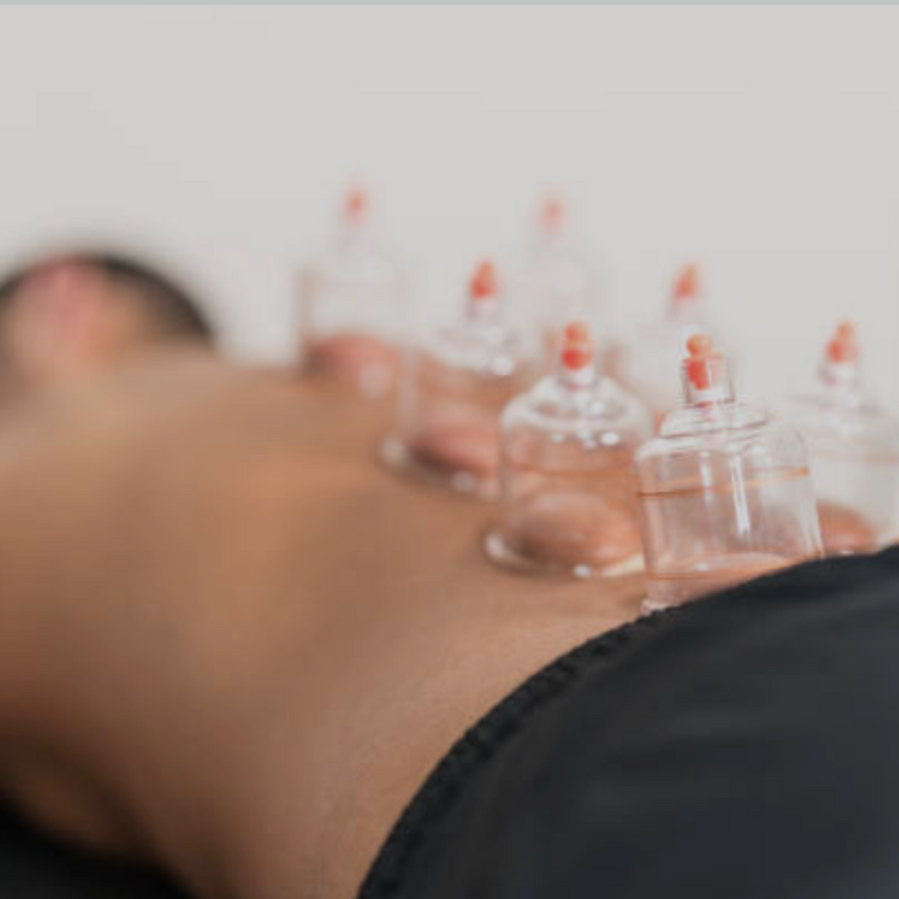 Cupping Therapy